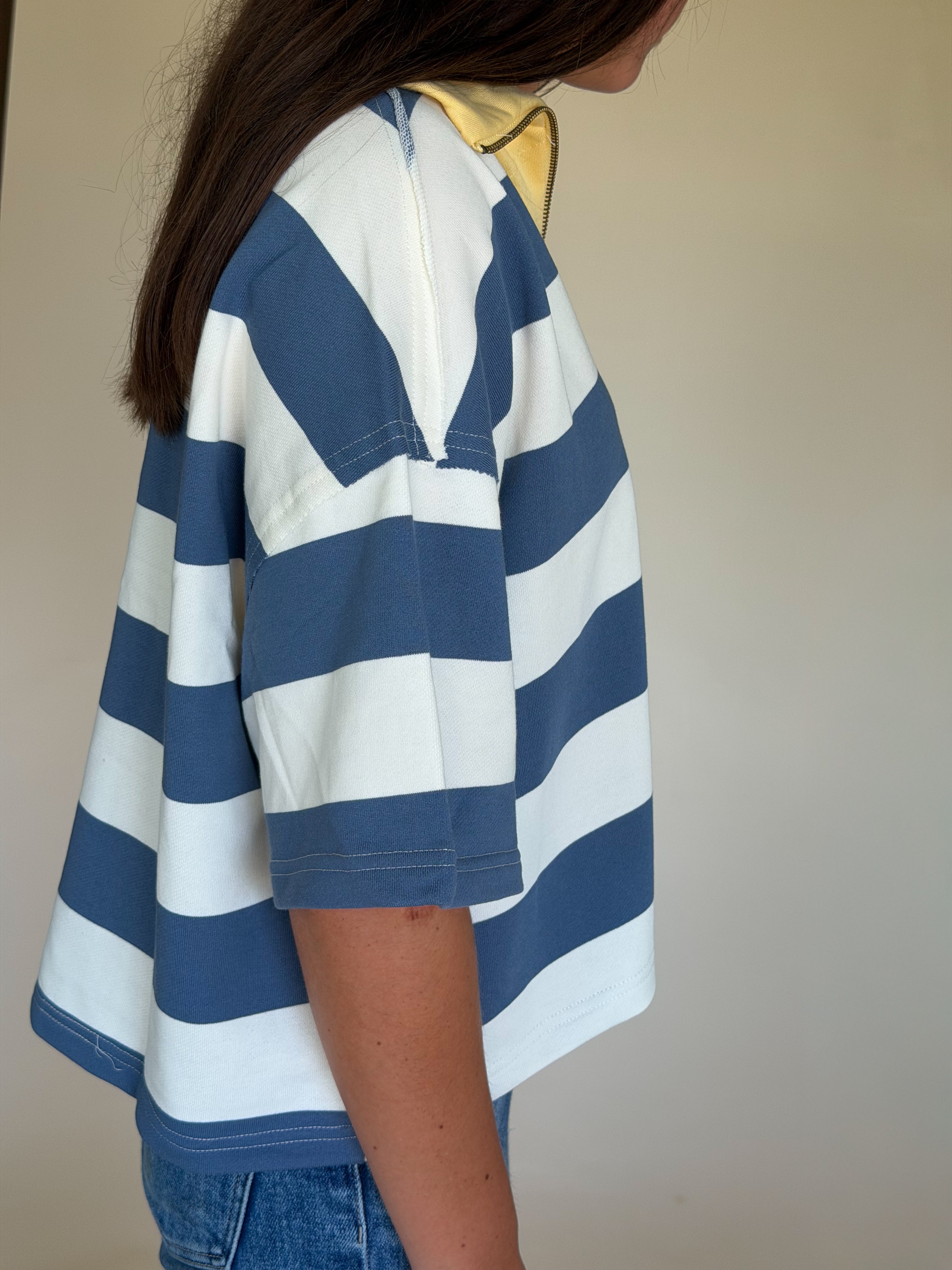 Oversized Striped Zip-Up Polo