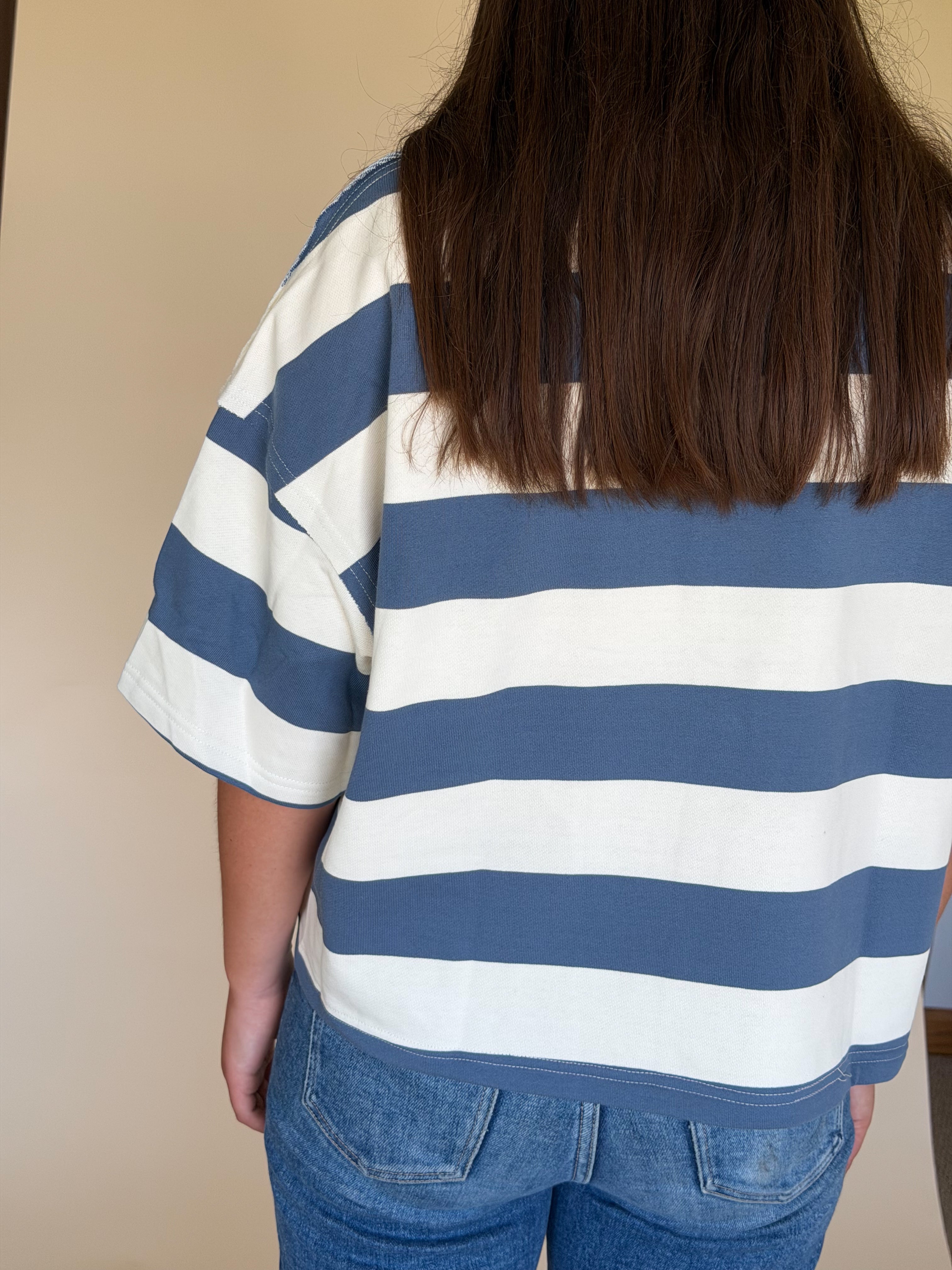 Oversized Striped Zip-Up Polo